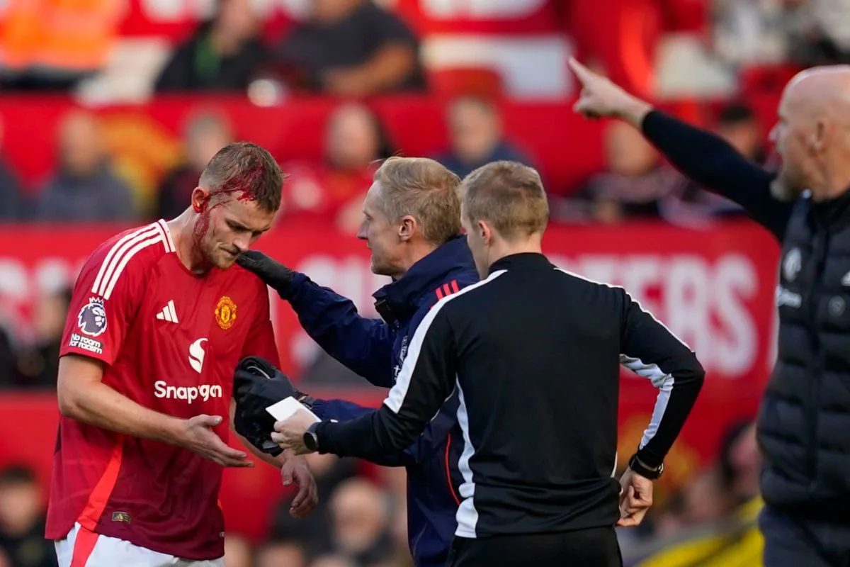 Matthijs de Ligt Sustains Cut on Head Against Brentford, Manchester United Concede While Temporarily Down to 10 Men